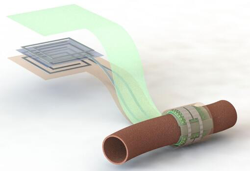上圖描繪了這款可生物降解的壓力傳感器，它圍繞著一根血管，天線在左側(cè)(分離的層狀結(jié)構(gòu)，展示了天線結(jié)構(gòu)的細節(jié))
